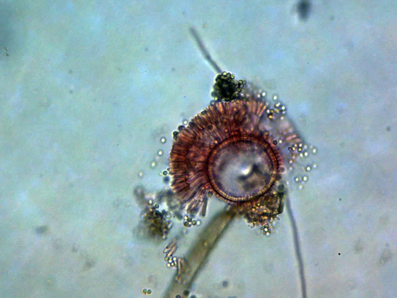 Aspergillus flavus 10 - Esporangio x 400 2